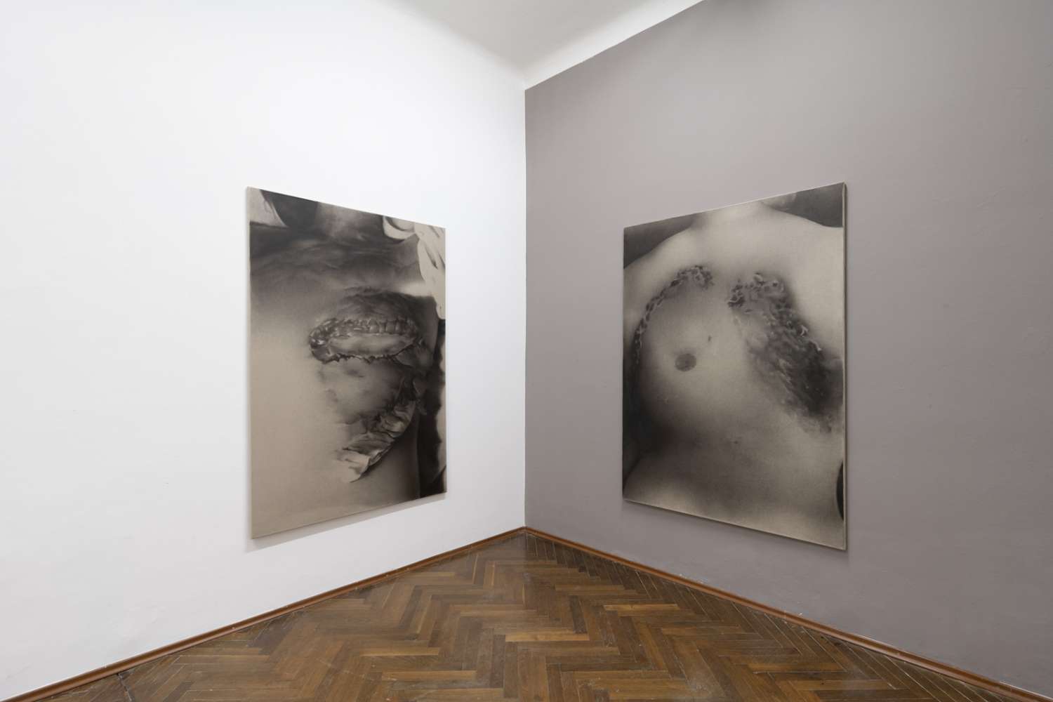 KRYSTYNA MELNYK: IN FRONT OF PAIN at GANDY GALLERY. Photo 1